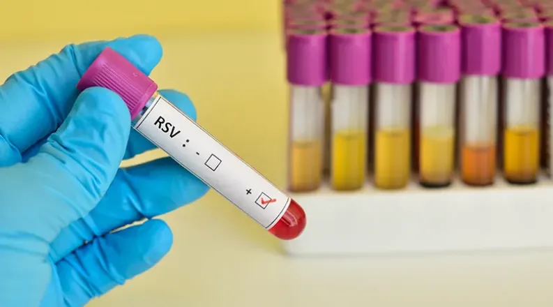 A blue-gloved hand holds a test-tube with a positive RSV tes