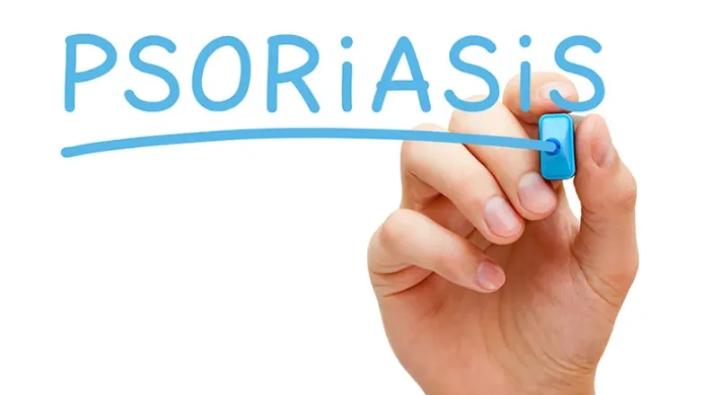 psoriasis