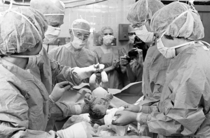 Doctors working on the first IVF