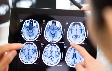 Skull Base Center MRI