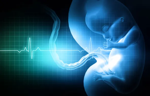 Profile of blue fetus with EKG chart superimposed