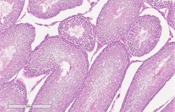 Image of pink purple specimens