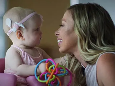 Baby Charly received a cochlear implant from EVMS.