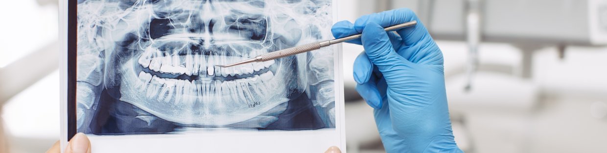 Hands holding a dental x-ray